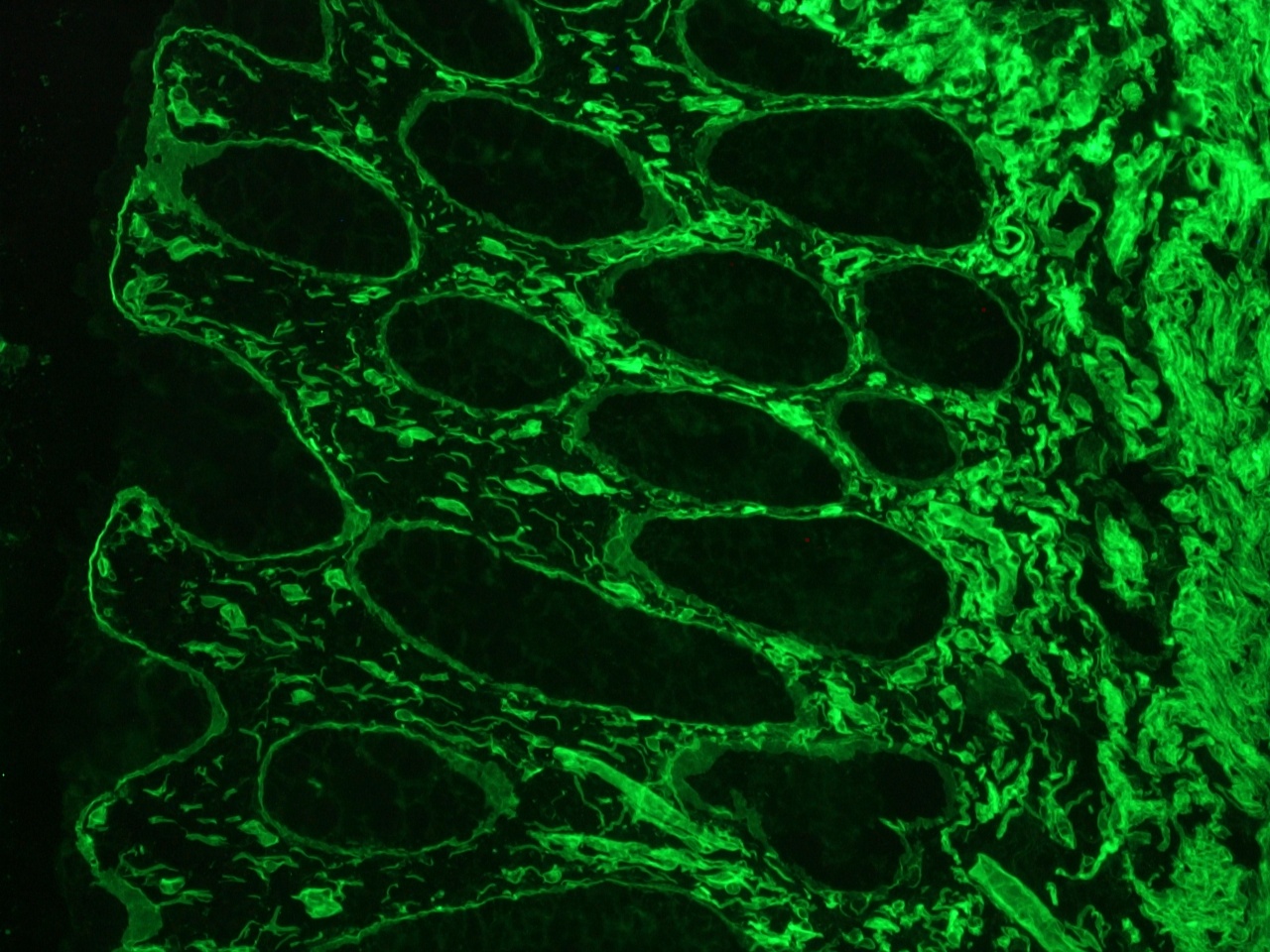 Figure 1. Immunofluorescence staining of frozen sections from human colon (methanol fixed) using MUB1100P, showing the localization of laminin in the connective tissue and in basement membranes surrounding the epithelial crypts and villi.